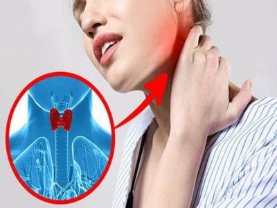 4 dấu hiệu cảnh báo sớm bạn đang mắc bệnh về tuyến giáp, từ bỏ ngay thói quen xấu này giúp ngừa bệnh hiệu quả