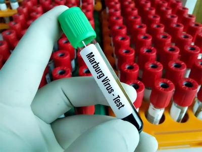Đường lây của virus khiến 9 người chết sau khi đi dự đám tang