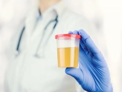 Nước tiểu nổi bọt, mệt mỏi quá độ, chàng trai sốc nặng khi nghe tin phải chạy thận
